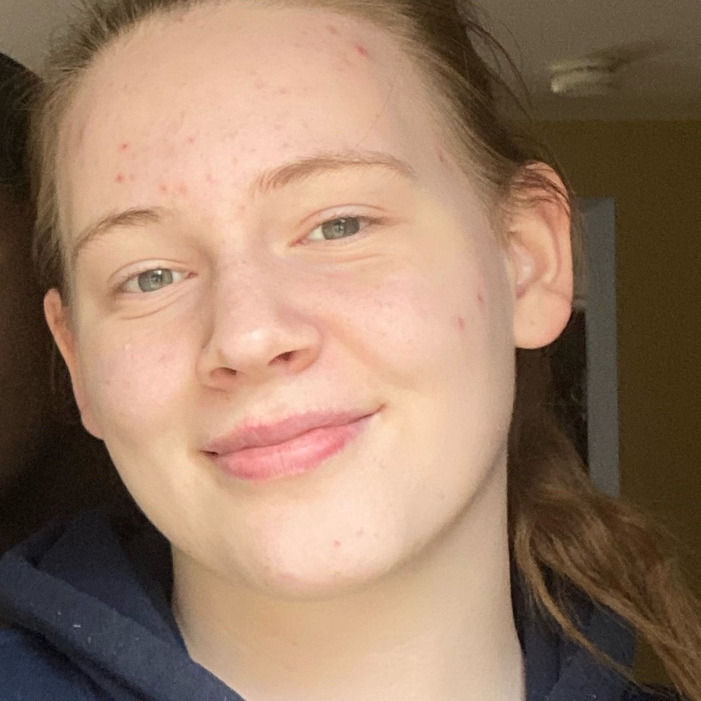 Meet your Posher, Melody